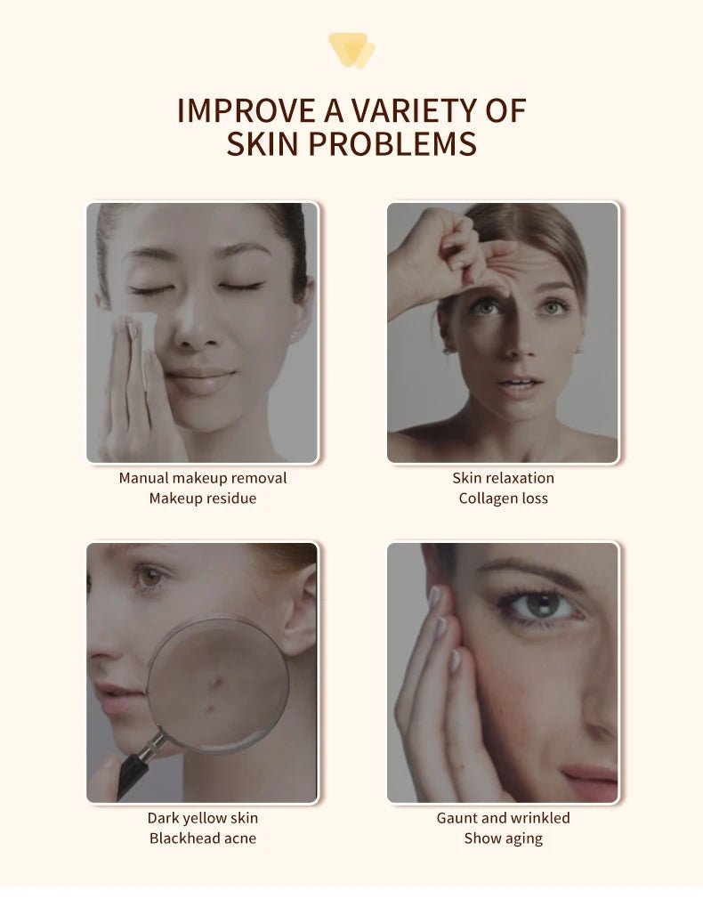 RF Facial Lifting & Tightening Beauty Device - Featured Mart