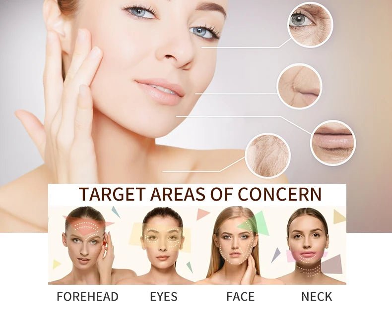 RF Facial Lifting & Tightening Beauty Device - Featured Mart