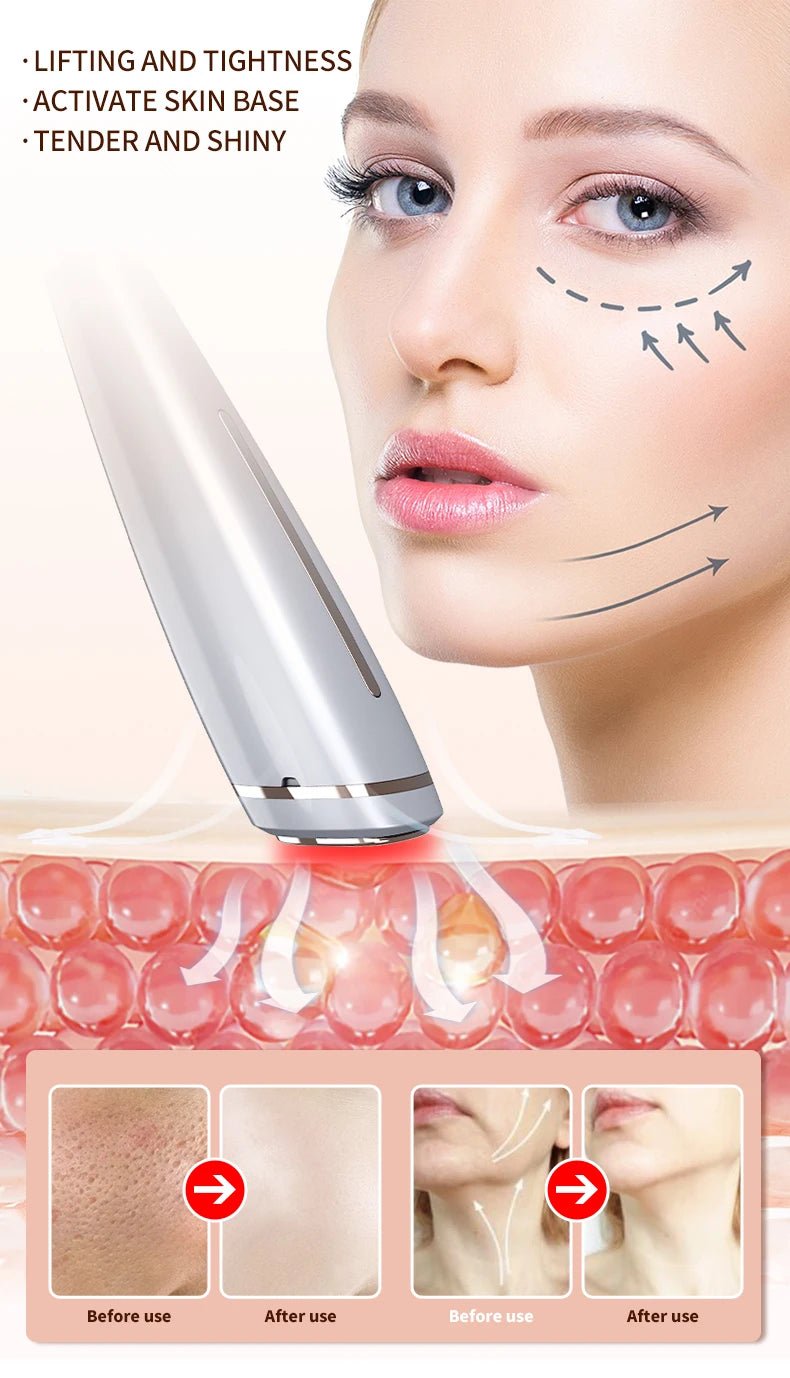 RF Facial Lifting & Tightening Beauty Device - Featured Mart